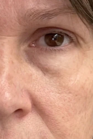 Sue, 65