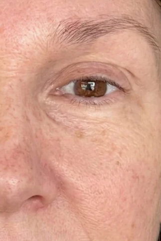 Sue, 65