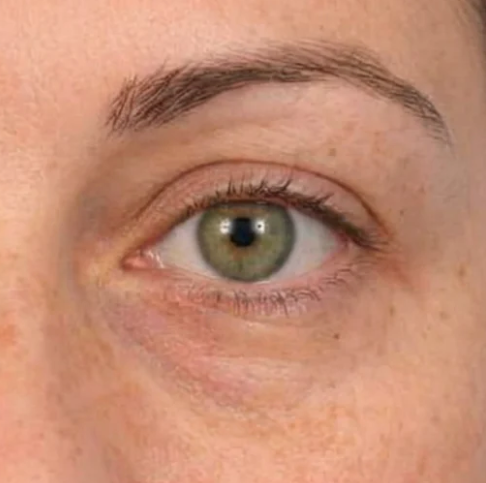 Lauren, 38