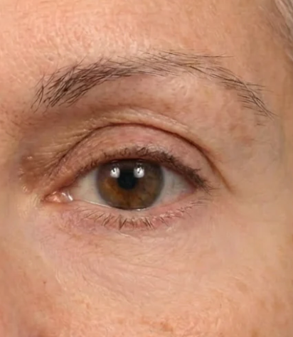 Karen, 35