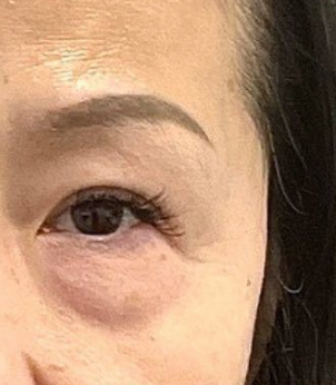 Hui, 43