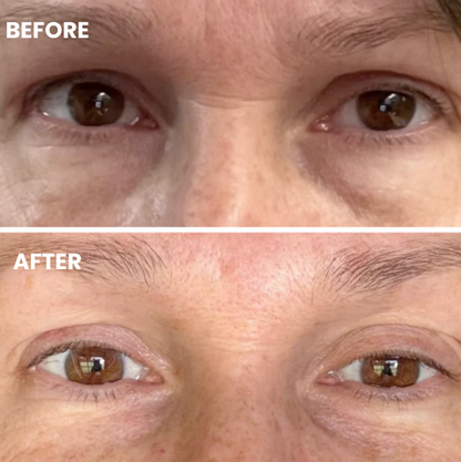Hydrolyzed Collagen Eye Masks with Honeycomb Technology