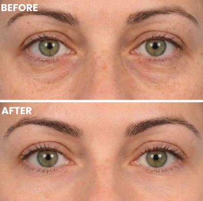 Hydrolyzed Collagen Eye Masks with Honeycomb Technology