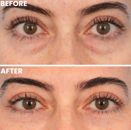 Hydrolyzed Collagen Eye Masks with Honeycomb Technology